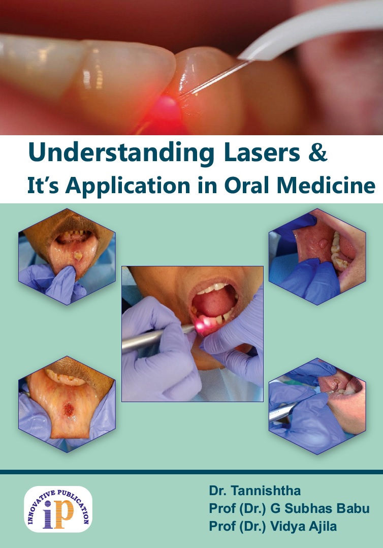 Understanding Lasers and it's Application in Oral Medicine