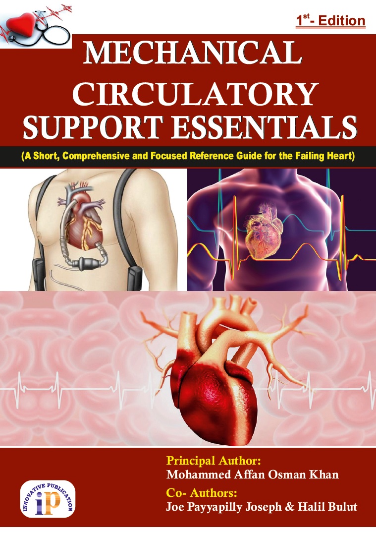 Mechanical Circulatory Support Essentials
