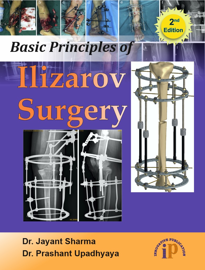 Basic Principles of Ilizarov Surgery (2e)