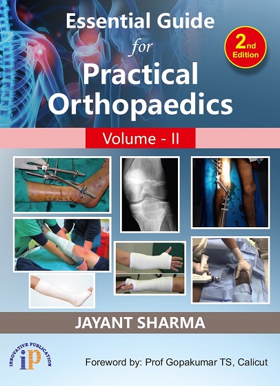 Essential Guide for Practical Orthopaedics - Vol II