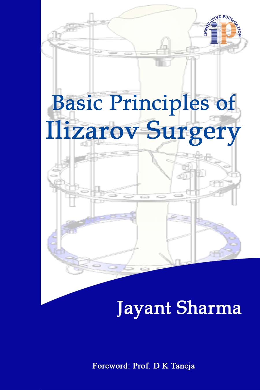 Basic Principles of Ilizarov Surgery