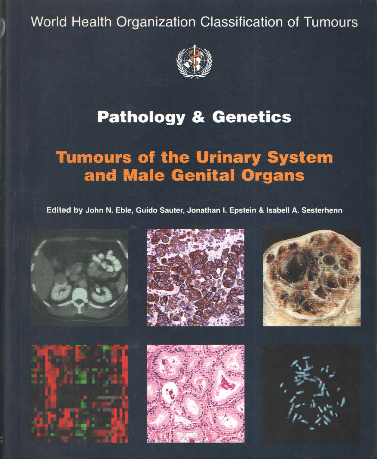 Pathology & Genetics Tumours Of The Urinary System And Male Genital Organs (WHO Classification Of Tumours)