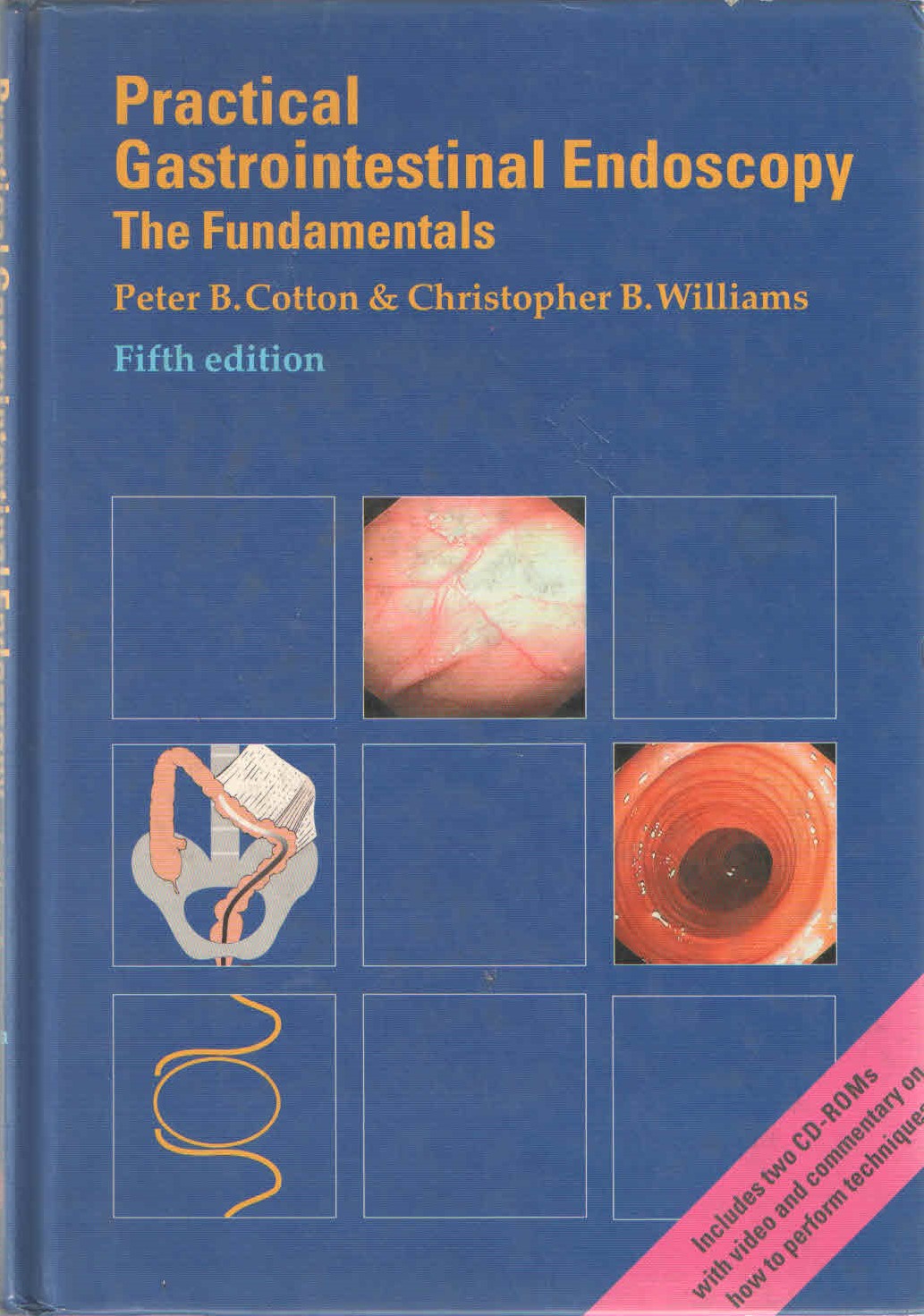Practical Gastrointestinal Endoscopy