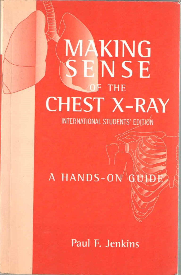 Making Sense Of The Chest X-Ray: A Hands-On Guide