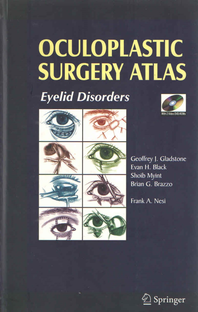 Oculoplastic Surgery Atlas Eyelid Disorders With 2 Video DVD-ROMS