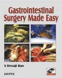 Gastrointestinal Surgery Made Easy with 2 CD-ROMs
