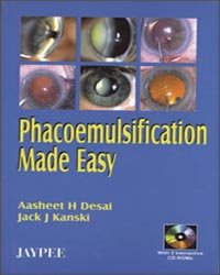 Phacoemulsification Made Easy (with 2 CD-ROMs)
