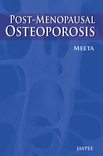 Postmenopausal Osteoporosis: Basic and Clinical Concepts