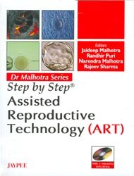 Dr Malhotra Series: Step by Step Assisted Reproductive Technology (ART) (With 2 Interactive DVD-ROMs)