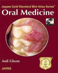 Jaypee Gold Standard Mini Atlas Series Oral Medicine