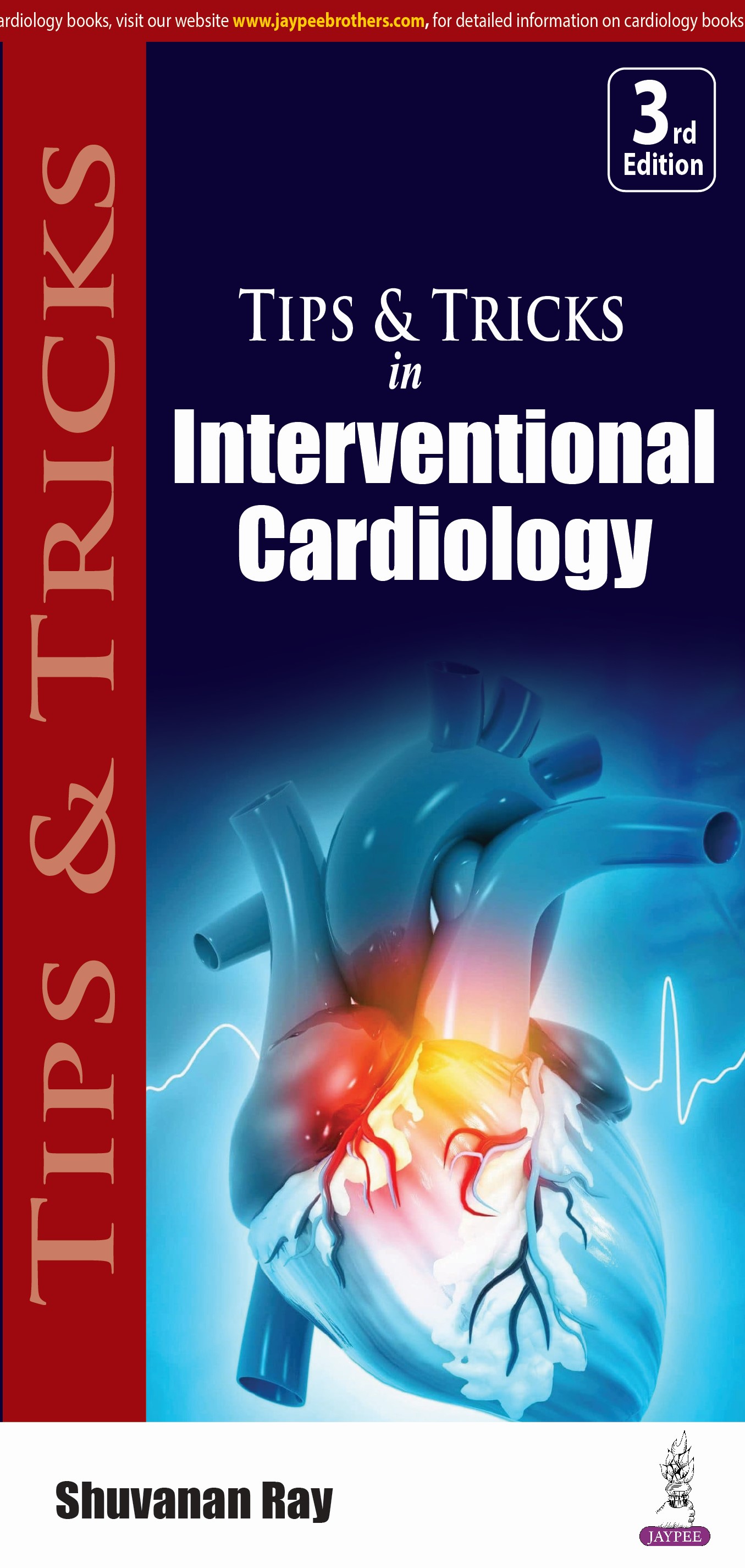 Tips Tricks In Interventional Cardiology