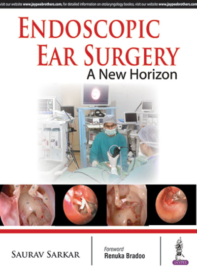 Endoscopic Ear Surgery: A New Horizon