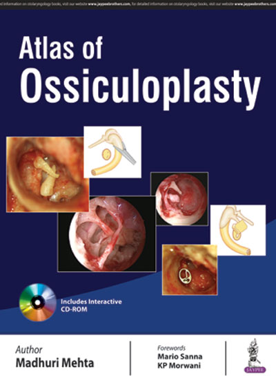 Atlas of Ossiculoplasty (Includes Interactive CD-ROM)