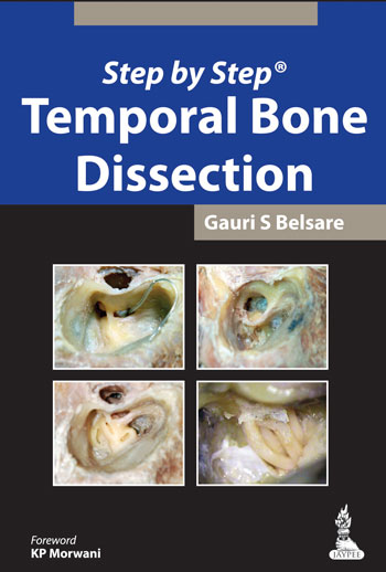 Step by Step Temporal Bone Dissection