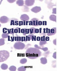 Aspiration Cytology of the Lymph Node