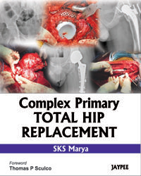 Complex Primary Total Hip Replacement