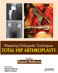 Mastering Orthopedic Techniques Total Hip Arthroplasty