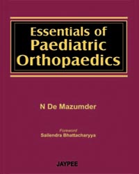 Essentials of Paediatric Orthopaedics