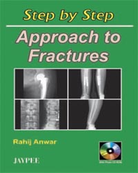 Step by Step Approach To Fractures (with CD-ROM)