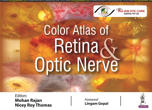 Color Atlas of Retina & Optic Nerve