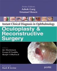 Instant Clinical Diagnosis in Ophthalmology: Oculoplasty and Reconstructive Surgery