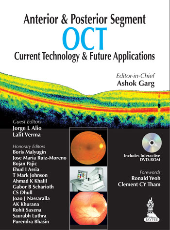 Anterior and Posterior Segment OCT: Current Technology and Future Applications