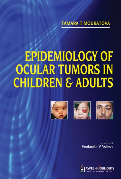 Epidemiology of Ocular Tumors in Children and Adults