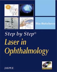 Step by Step Laser in Ophthalmology (with Photo CD-ROM)