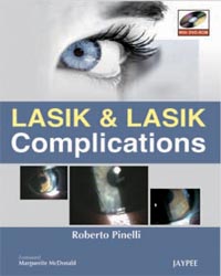 Lasik and Lasik Complications (with DVD-ROM)
