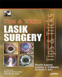 Tips & Tricks in Lasik Surgery (with DVD-ROM)