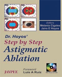 Dr Hoyos' Step by Step Astigmatic Ablation with Photo CD-ROM