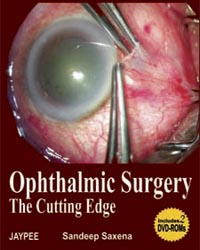 Ophthalmic Surgery: The Cutting Edge with 2 DVD-ROMs (Complete Book Available in PDF Format)