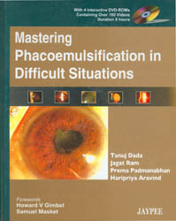 Mastering Phacoemulsification in Difficult Situations with 4 DVD-ROMs