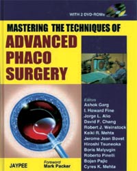 Mastering the Techniques of Advanced Phaco Surgery (with 2 DVD-ROMs)