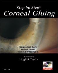 Step By Step Corneal Gluing with DVD-ROM