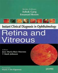 Instant Clinical Diagnosis in Ophthalmology: Retina and Vitreous