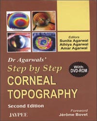Dr Agarwal's Step by Step Corneal Topography (With DVD-ROM)