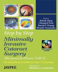 Step by Step Minimally invasive Cataract Surgery BiManual Phaco-MICS) with CD-ROM