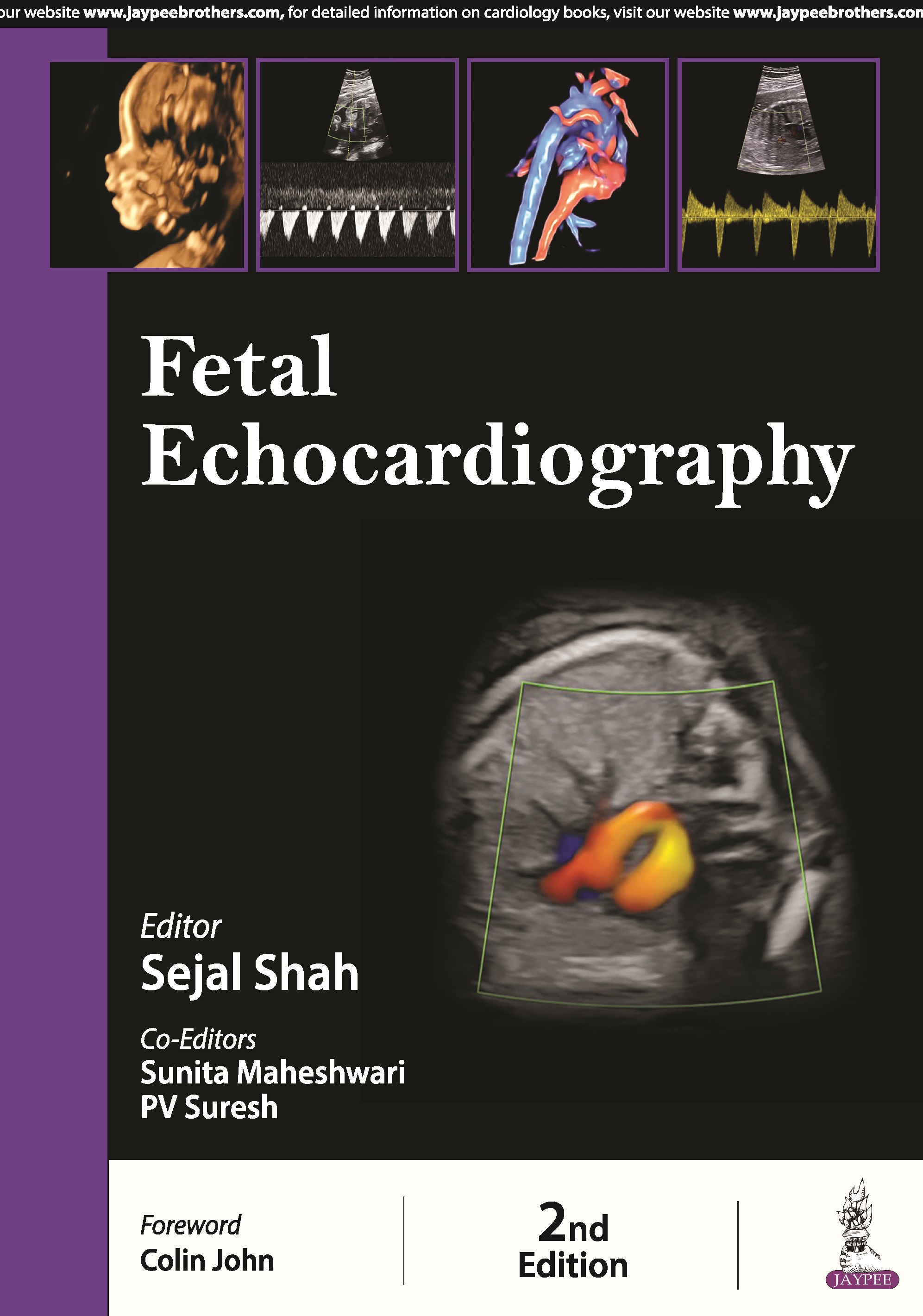 Fetal Echocardiography