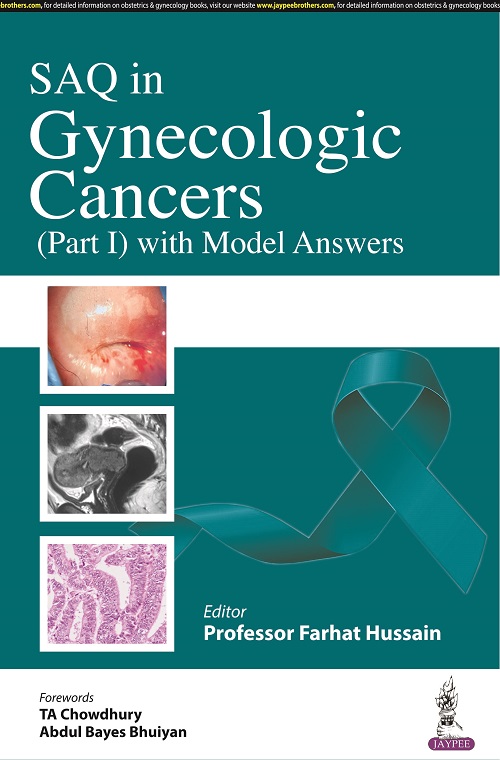 SAQ in Gynecological Cancers (Part 1) With Model Answers