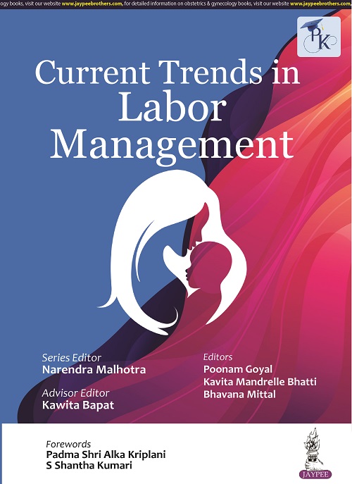 Current Trends in Labor Management
