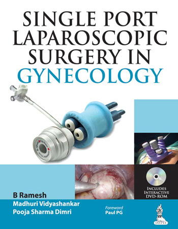  Single-Port Laparoscopic Surgery in Gynecology