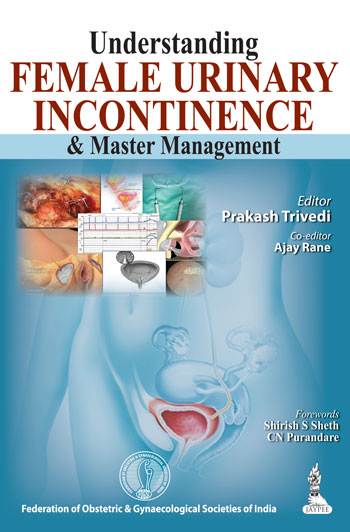 Understanding Female Urinary Incontinence and Master Management