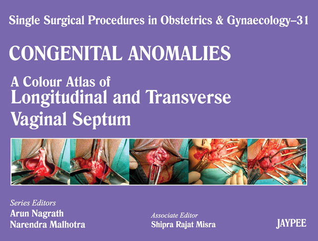 Single Surgical Procedures in Obstetrics and Gynaecology-31: Congenital Anomalies-A Colour Atlas of Longitudinal and Transverse Vaginal Septum