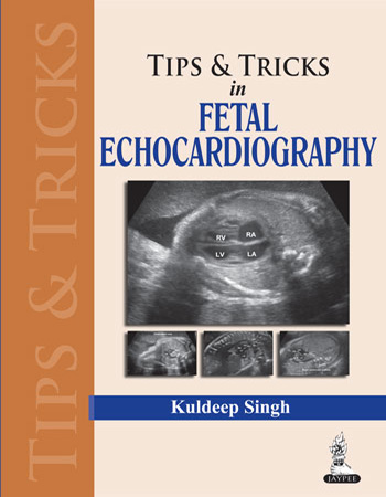 Tips and Tricks in Fetal Echocardiography