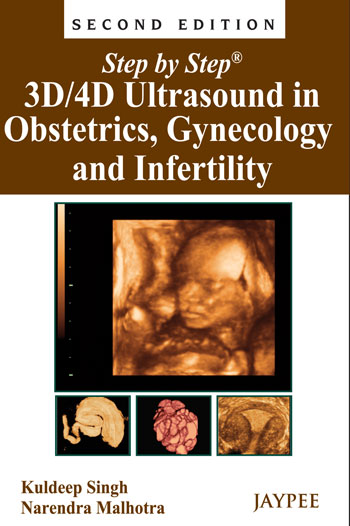 Step by Step 3D/4D Ultrasound in Obstetrics, Gynecology and Infertility