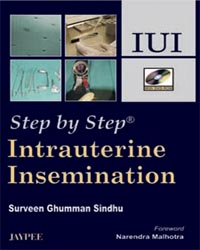 Step by Step Intrauterine Insemination (with DVD-ROM)