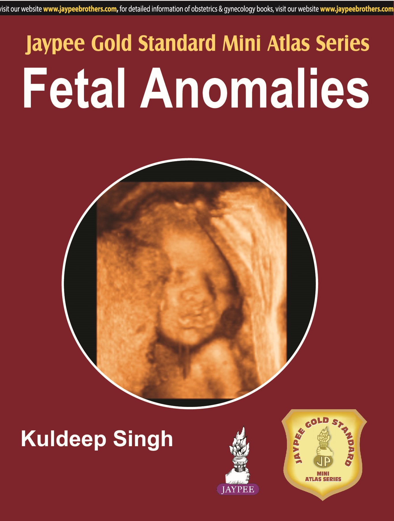 Jaypee Gold Standard Mini Atlas Series Fetal Anomalies
