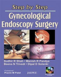 Step by Step Gynecological Endoscopy Surgery (with 2 CD-ROM)