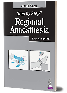 Step by Step Regional Anaesthesia